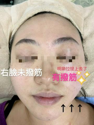 天使美妍坊 - 實際成果~回春撥筋搭心型氣刷及臉部精油的驚人效果:-)