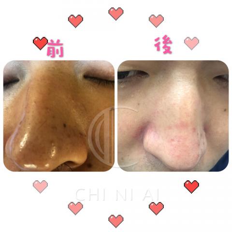 奇霓嬡著迷時尚奢華坊 - 別意外?
我們美容師Bubu也有做男士護理課程唷?
今天來了長期在國外出差工作的男性朋友
來體驗肌膚護理
原本肌膚問題：易長粉刺，暗沉及肌膚缺水，此狀況肌膚容易出油
經由美容師Bubu調理後，肌膚負擔完全減輕，光澤度也直接提升
所以不是只有女生需要保養護理，男生其實也是非常需要保養及護理

本公司現在有 
母親節（預購活動）
請直接私問小編?
千萬別錯過唷?

?為您 服務/諮詢/預約/