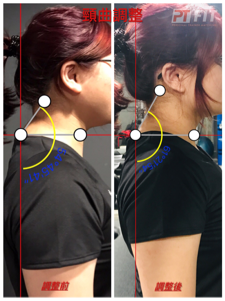 Steven - 頸曲度調整