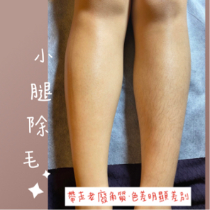 閨蜜 BFF. Love 專業熱蠟除毛 - 