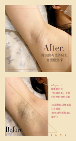 閨蜜 BFF. Love 專業熱蠟除毛 - 