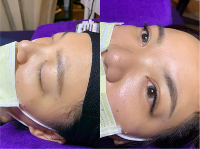 Juan半永久紋繡 美睫 - 改紅眉