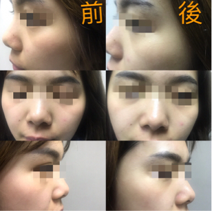 薩曼莎療心室 - 保養後呈現