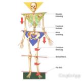 南港內湖🏋️體驗 - 體態歪斜示意圖 南港內湖🏋️體驗 - 體態歪斜示意圖