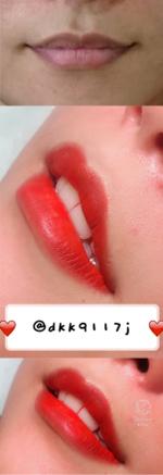 Destino 美學 - 美唇