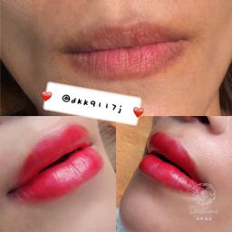 Destino 美學 - 美唇