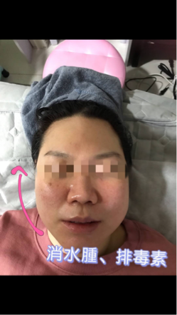 艾蕊形象管理中心 - 顱內課程前後