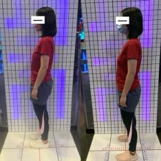 Alyssa艾莉莎 - 體態調整/1.5個月對比（身體歪斜）