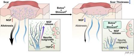 Akira Yang - SCI 論文摘要圖. https://doi.org/10.1093/asj/sjab105 Akira Yang - SCI 論文摘要圖. https://doi.org/10.1093/asj/sjab105