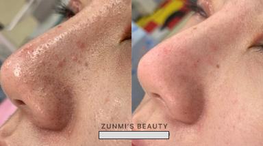 尊宓美學工作室 - 臉部保養