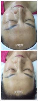 向陽美容spa - 這是我的太極拳老師，做完前後效果