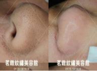 茗緻紋繡美容館 - 毛孔大掃除