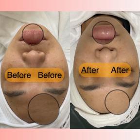 aura healing凈境美身心靈美學 - 淡化細紋