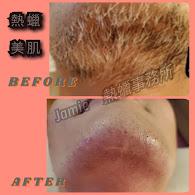 KiKi技導/美容師 - 熱蠟淨毛
全     臉~ 1500               唇   周~ 300            鼻  毛~  300
臉     頰~ 400                 下   巴~ 800            眉  毛~  300
全鬍子~ 1000                鬢   角~ 600
 KiKi技導/美容師 - 熱蠟淨毛
全     臉~ 1500               唇   周~ 300            鼻  毛~  300
臉     頰~ 400                 下   巴~ 800            眉  毛~  300
全鬍子~ 1000                鬢   角~ 600