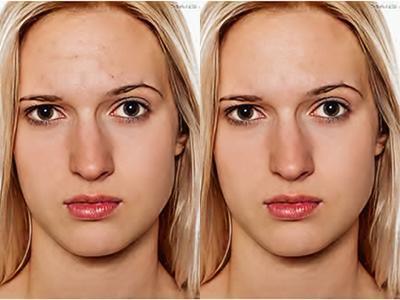 Tommy - 皮膚修飾