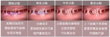 重華撥筋傳統整復推拿 - 