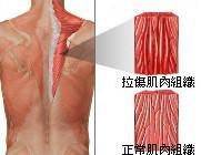 重華撥筋傳統整復推拿 - 