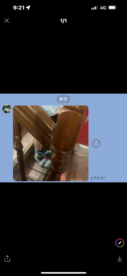 樓梯扶手案件圖片