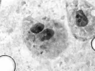 生物科家教 - 豬肝細胞