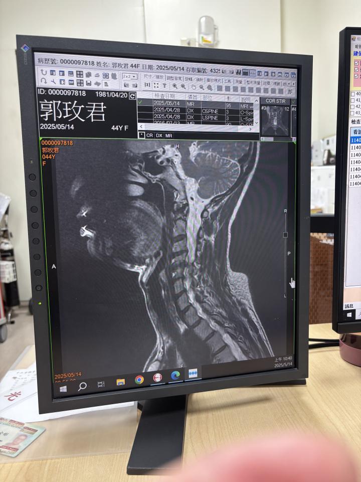 傳統整復推拿案件圖片