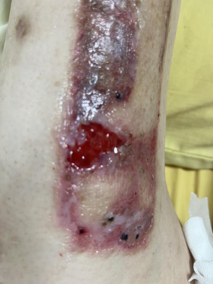 民事糾紛處理案件圖片