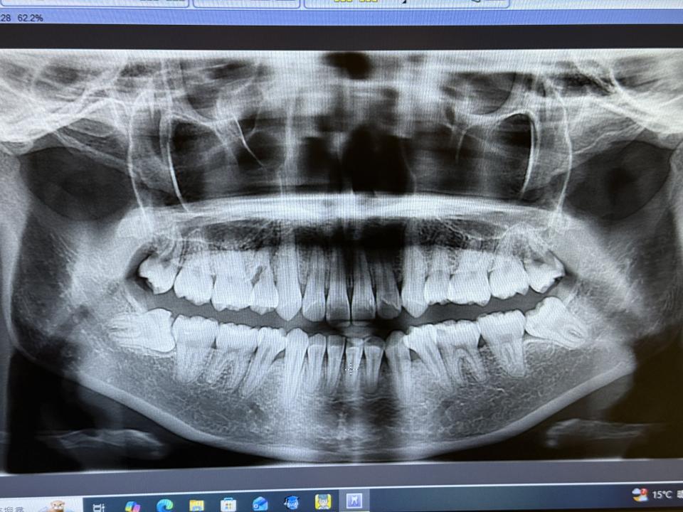 民事糾紛處理案件圖片