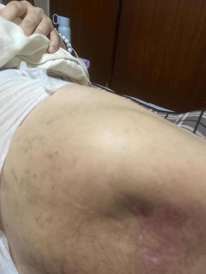 傳統整復推拿案件圖片