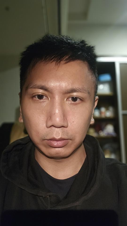 傳統整復推拿案件圖片