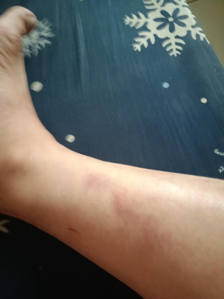 傳統整復推拿案件圖片