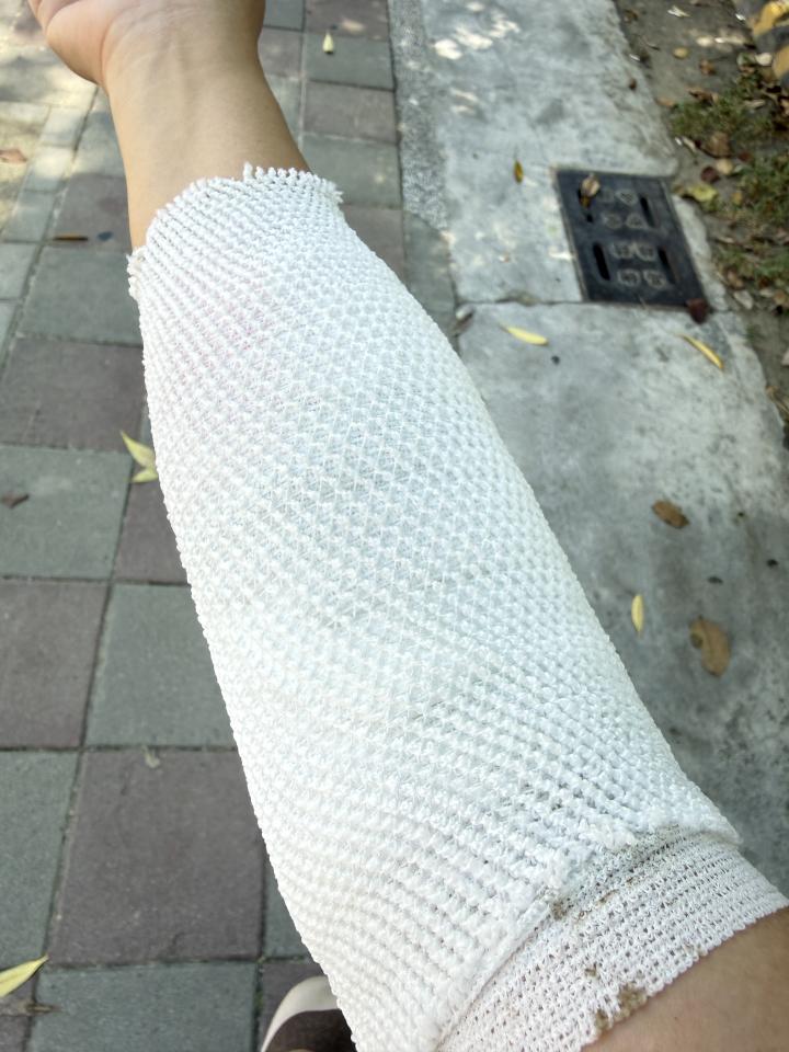 傳統整復推拿案件圖片