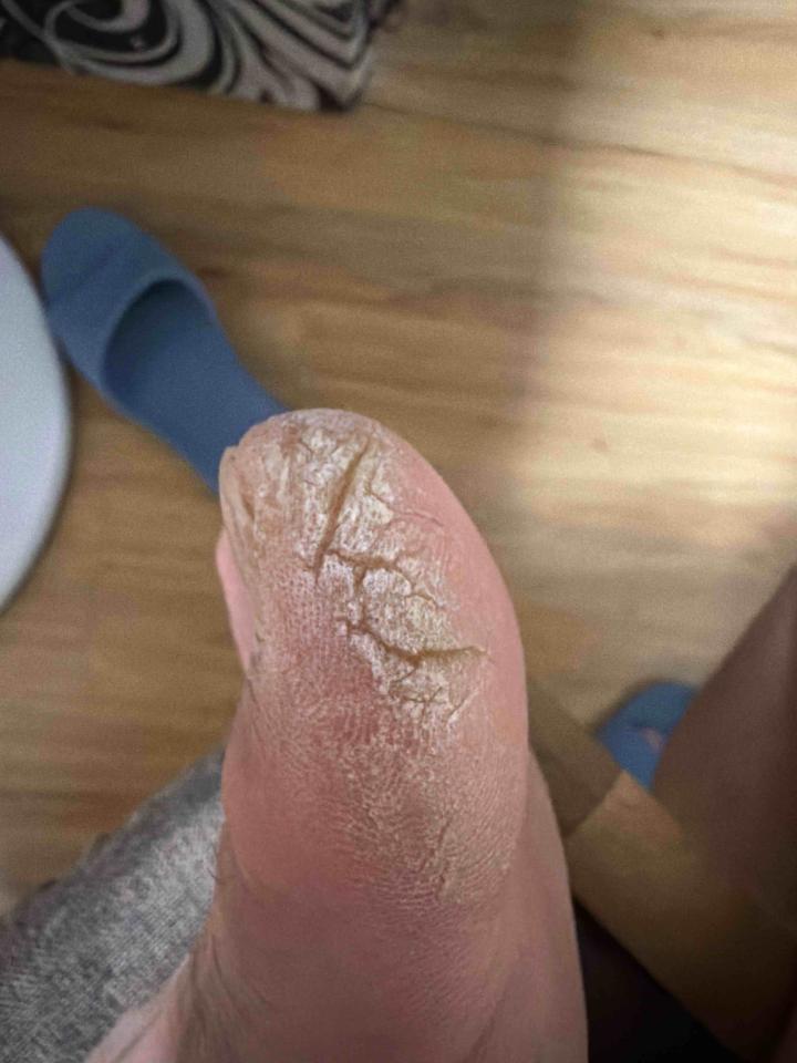 傳統整復推拿案件圖片