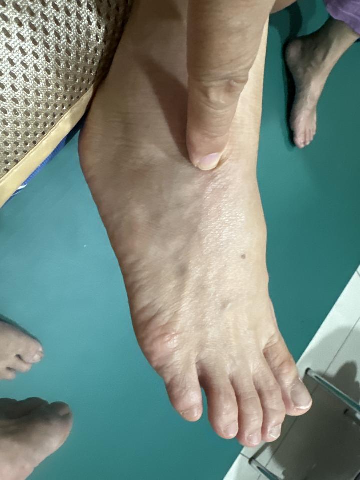 傳統整復推拿案件圖片