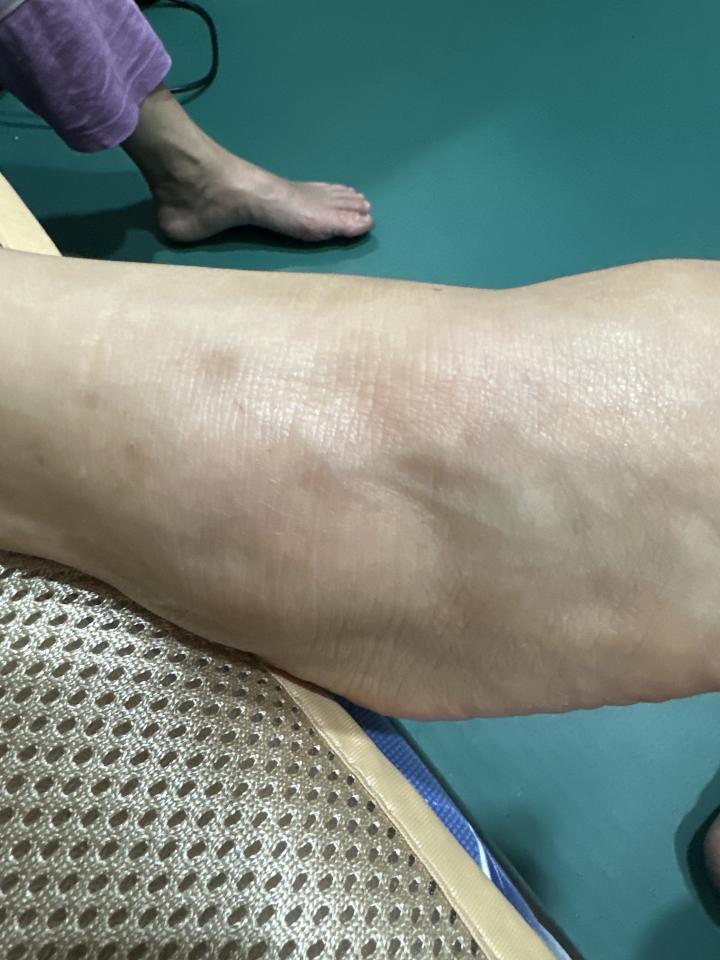 傳統整復推拿案件圖片