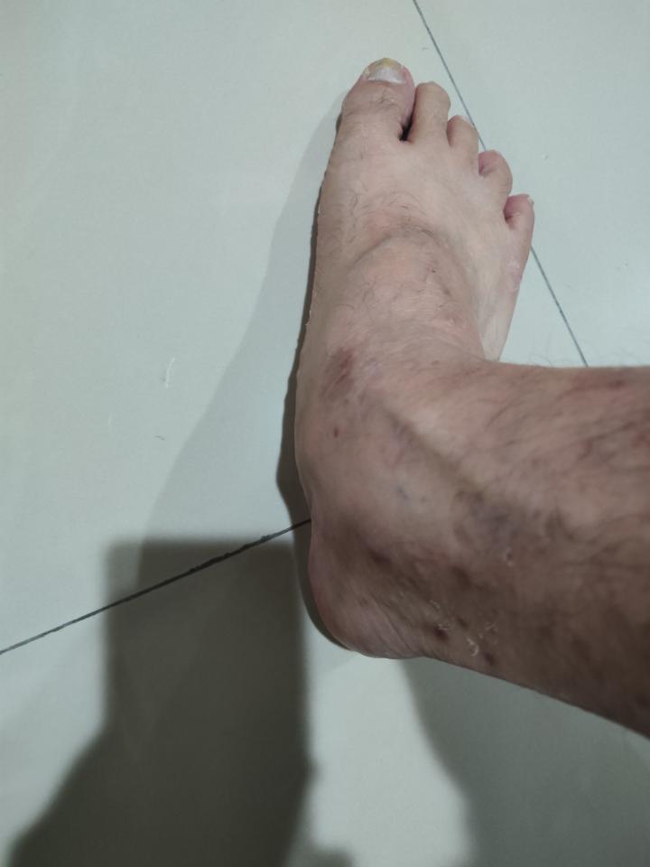 傳統整復推拿案件圖片