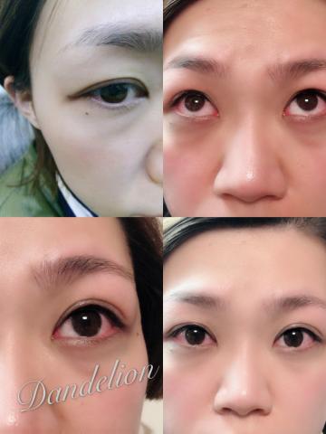 Dandelion 蒲公英時尚美學工作室 - 韓式美瞳