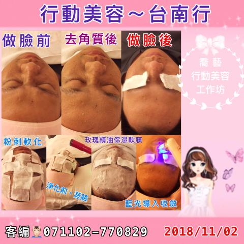 喬藝美容工作坊 - 無痛深層粉刺淨化保濕療程/做臉前、後。