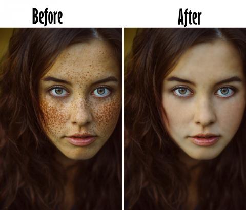 Ling - 臉部調色去斑