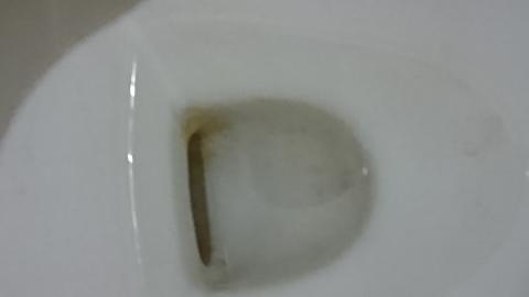 佳居家事服務有限公司 - 清潔前的馬桶內的尿垢黃垢