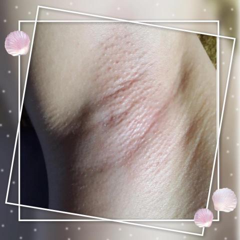 Dana魔力美學 - 沙灘、海邊、怎能不高舉雙手歡呼，怎能讓腋毛影響我們的興致呢？