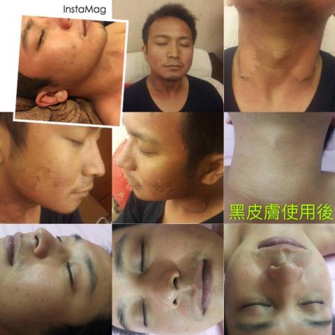 水銥釩美學SPA - 藻針