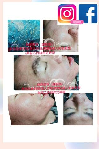 顏囍／囍顏美學 - 專業粉刺處理