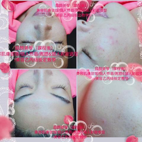 顏囍／囍顏美學 - 專業內胞處理