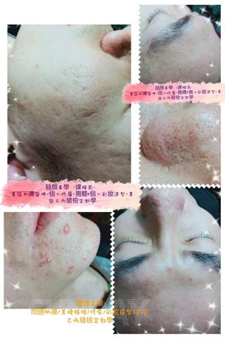 顏囍／囍顏美學 - 課程前