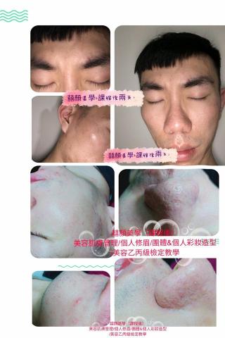 顏囍／囍顏美學 - 課程後