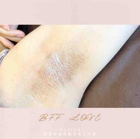 閨蜜 BFF. Love 專業熱蠟除毛 - 