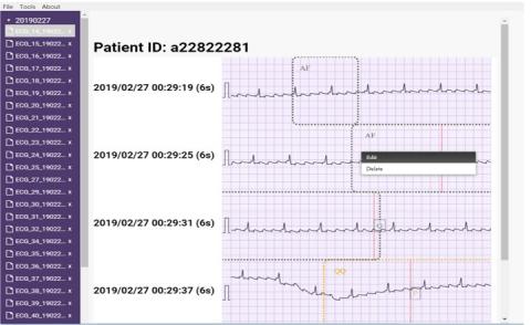 CJ軟體工作室 - Electron 桌面程式心電圖軟體