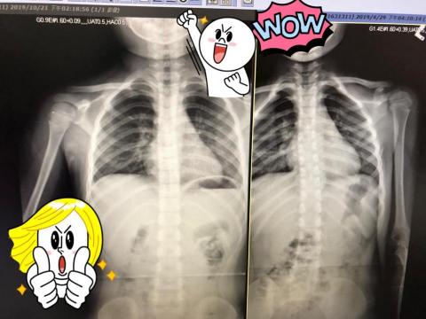 陳姿彣 - 兒童彼拉提斯脊椎姿勢調整