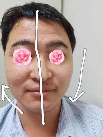 薩曼莎療心室 - 做完臉立即有效果