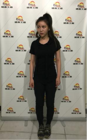 Seven-私人教練 - T 瘦，但體脂肪稍高 車禍過後骨盆歪斜，導致高低肩，脊柱側彎。