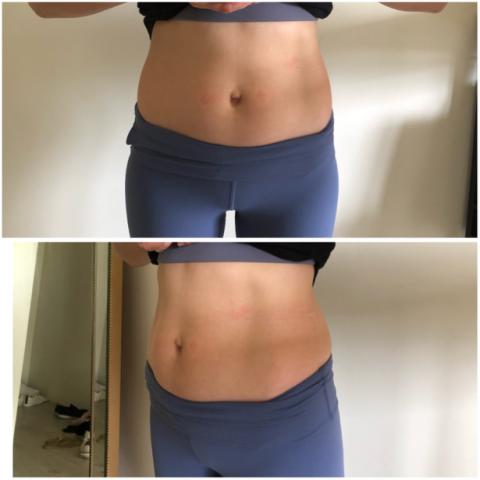 Mimiann 美容美學 - 媽媽的願望-平坦的小腹成效2